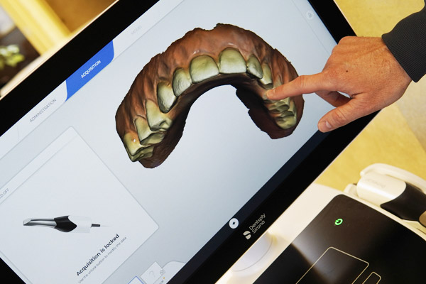 Dental Scan